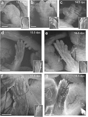 Mouse embryo phenotyping with optical coherence tomography